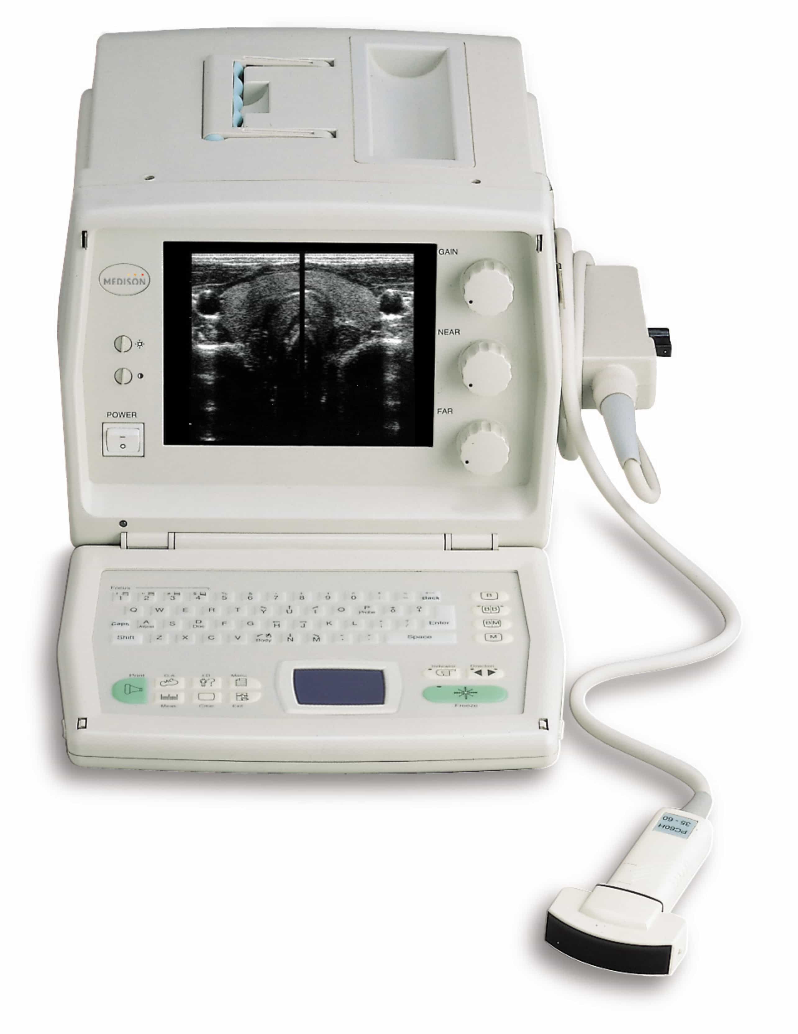 УЗИ SonoAce 600 — подбор запчастей